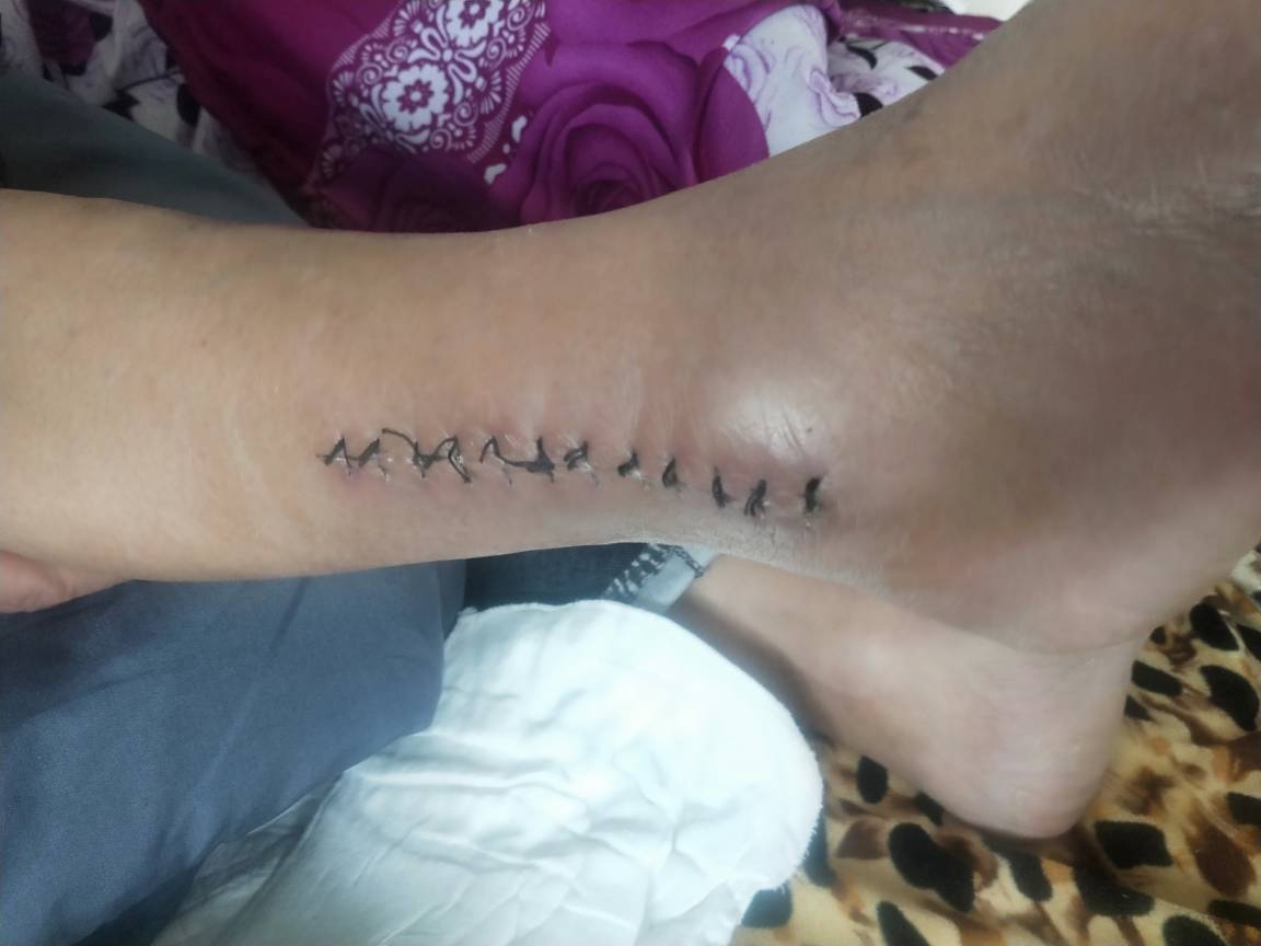 JJ比赛如何把元宝兑换成金